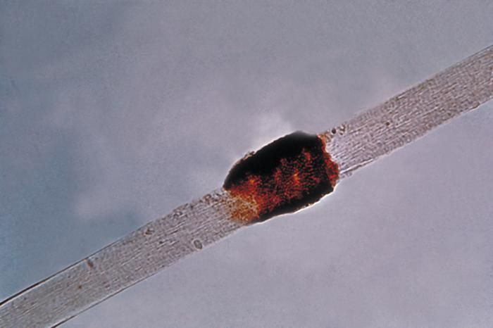 Piedraia hortae ~ Everything You Need to Know with Photos | Videos