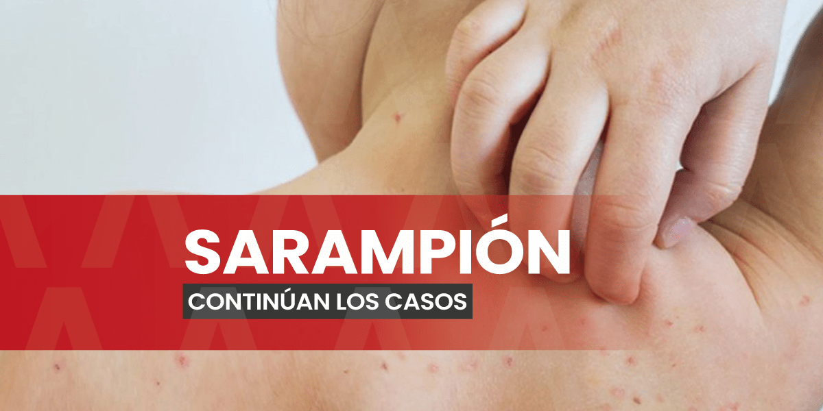 Chiapas acumula 640 casos confirmados de sarampión