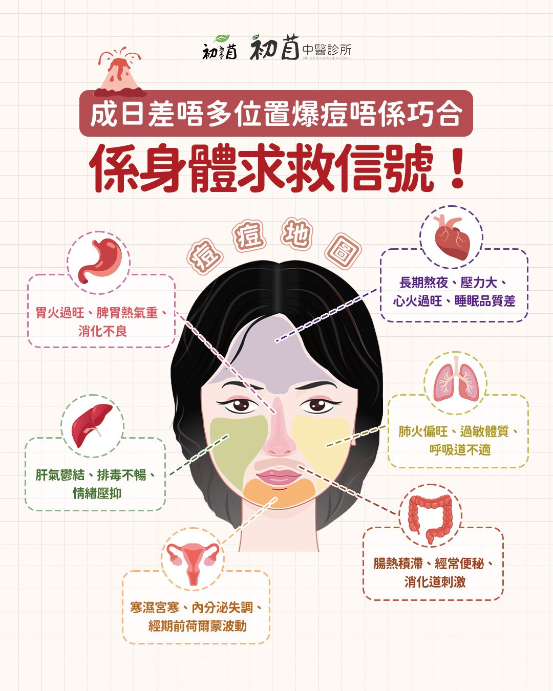 暗瘡