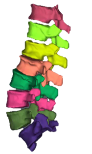 Spinal segmentation CSIRO's Data61