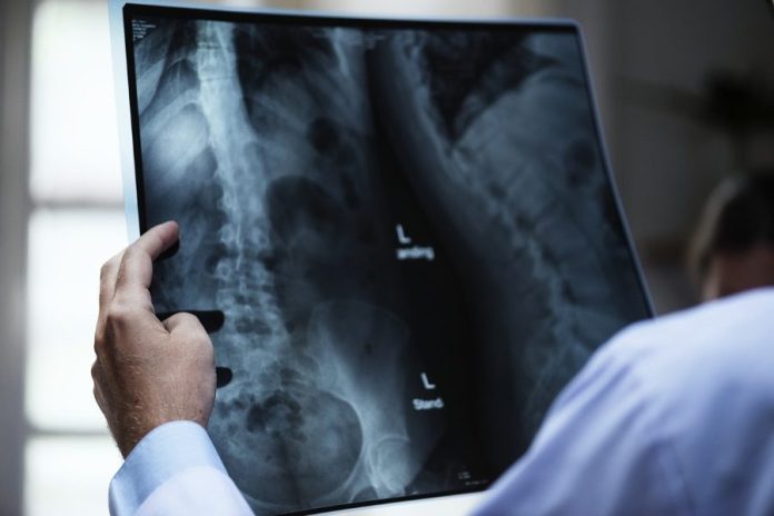 Artificial Intelligence Drives Innovation In Radiology Tools