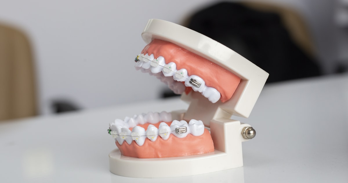 The Benefits of Early Orthodontic Assessment