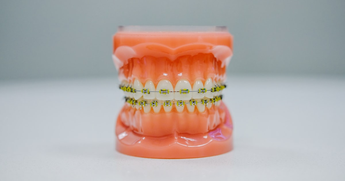 Flexible Payment Plans for Orthodontics