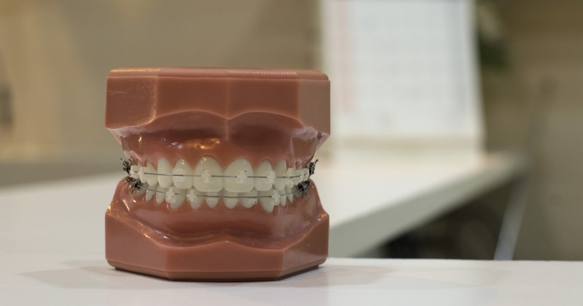 Understanding Orthodontic Treatments