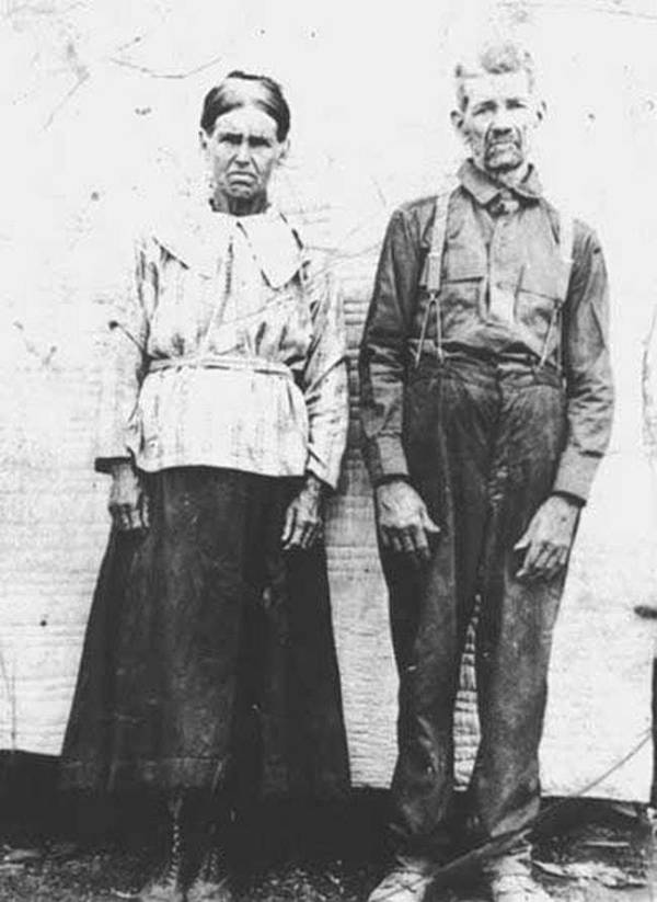 Why The Fugate Family Are Literally "The Blue People Of Kentucky"