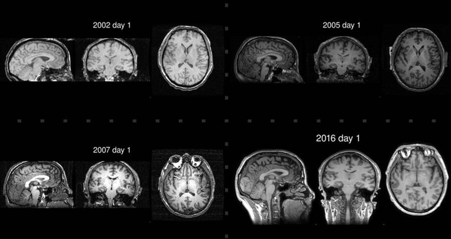 Though i am certainly no “olympian meditator” (as the scientists call people like mingyur rinpoche), i have been practicing since i was a . Scientists Discovered This Buddhist Monk S Brain Is Younger Than He Is