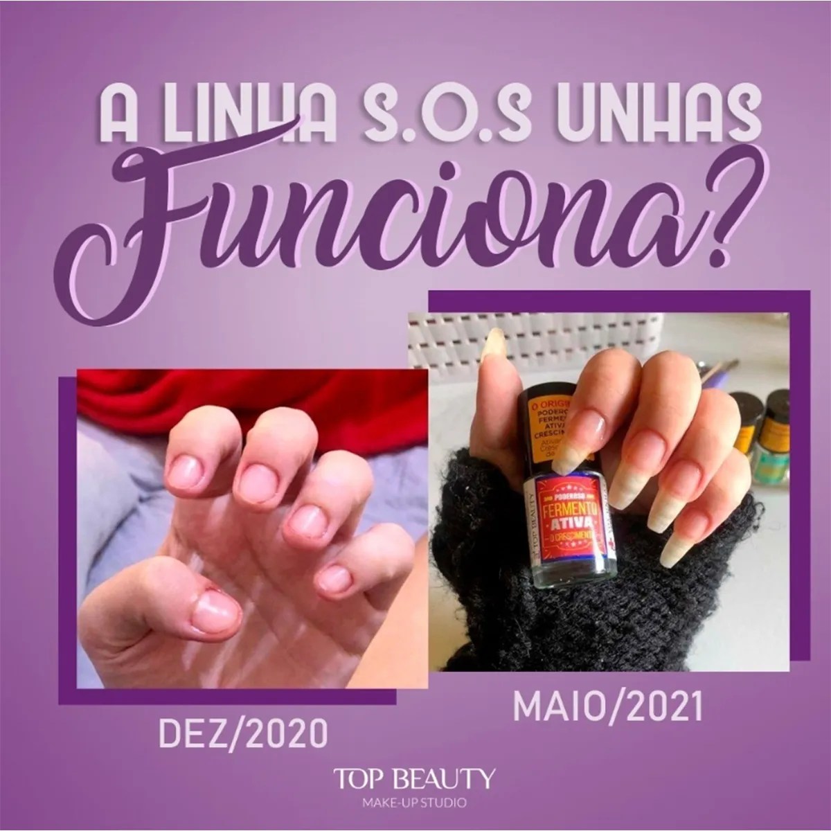 Montagem de antes e depois de unhas apresentada pela linha SOS Unhas Top Beauty