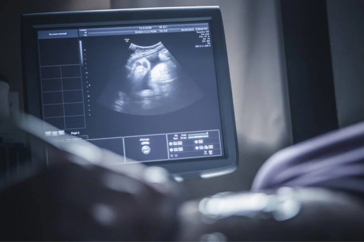 اكتشاف مذهل: جنين داخل بطن سيدة منذ 40 عامًا!