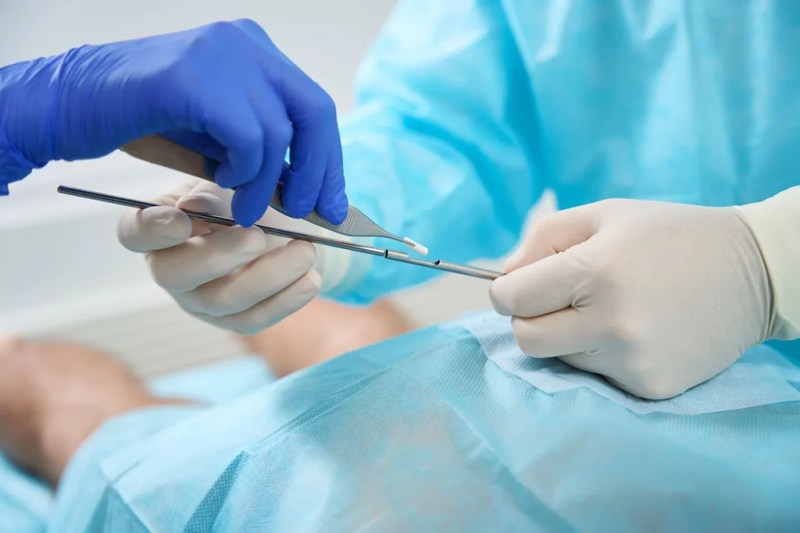 Clinician preparing a hormone pellet insertion