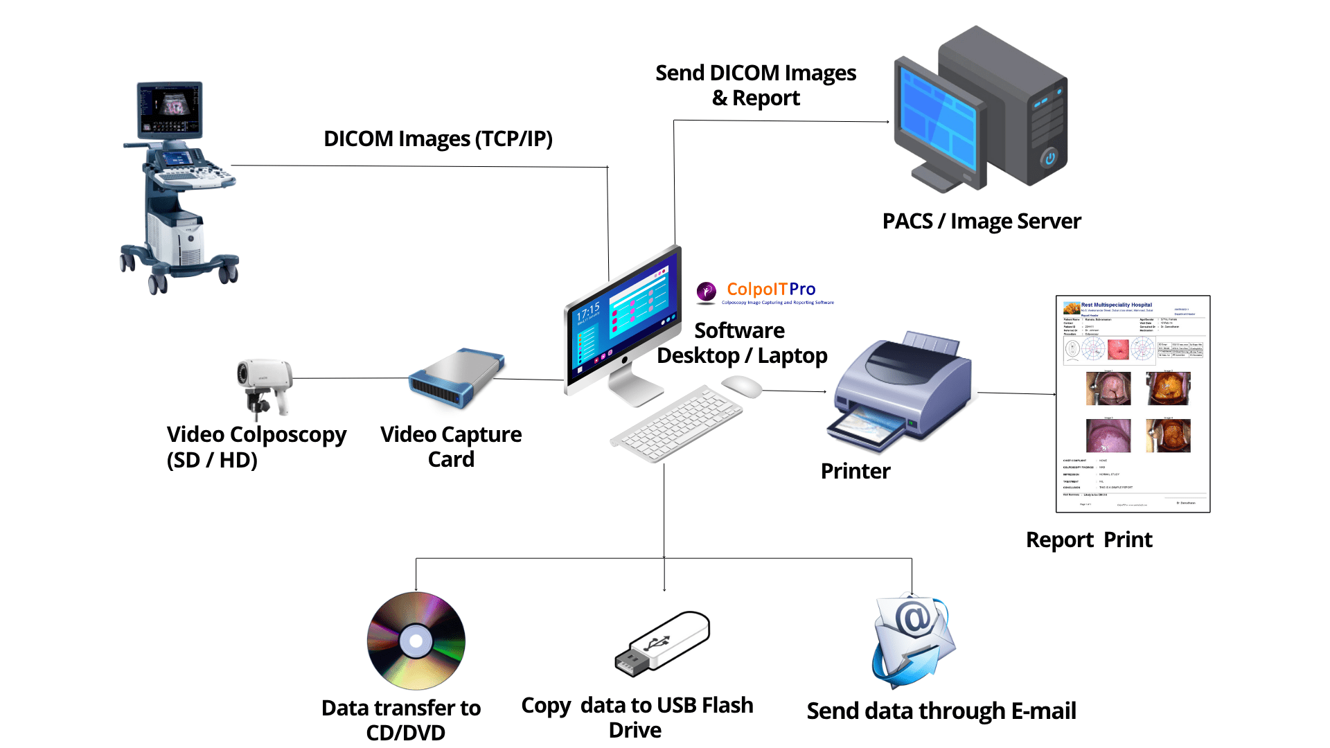 video colposcopy sd hd.webp