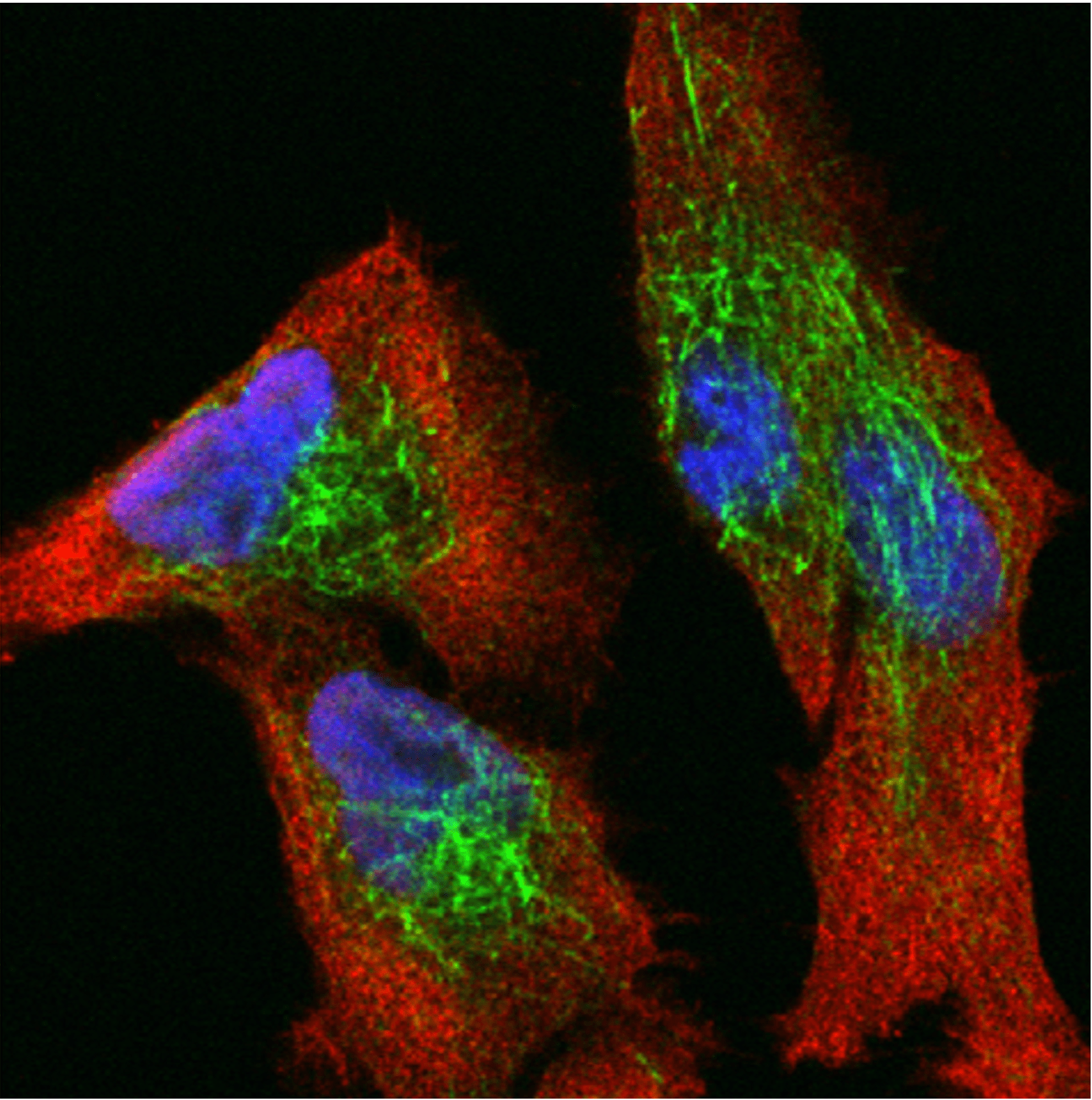 Our article on live-cell imaging of HIV-1 and host cell proteins