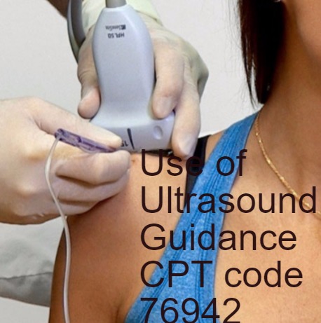 Common mistakes with CPT code 76942