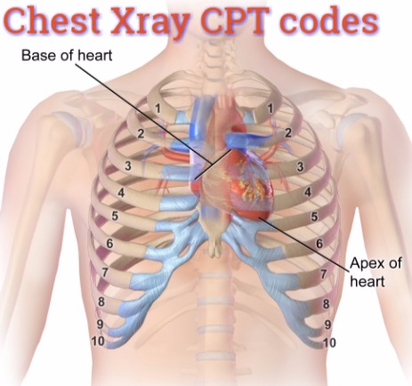 Cpt Code 71020 and 71010 chest x ray Coding guide