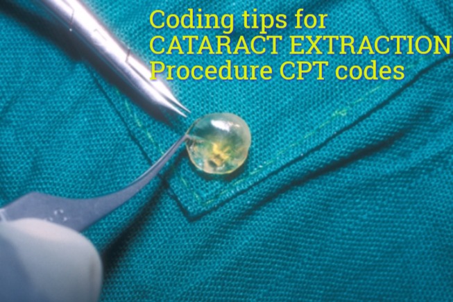 Coding tips for CPT code 66984, 66840, 66850, 66852, 66983, 66985, 66982, 66920