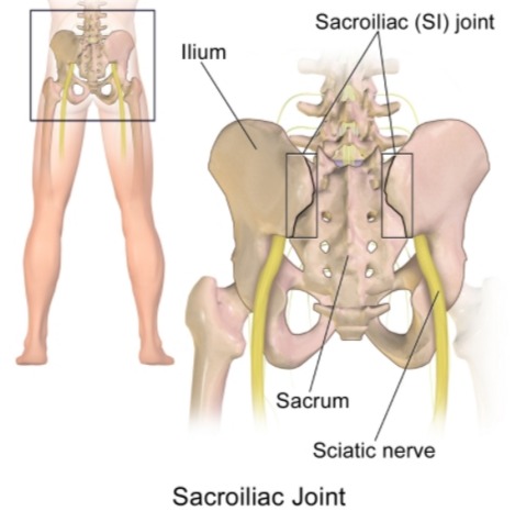 When to use Sacroiliac (SI) joint injections CPT code 27096, G0259, G0260