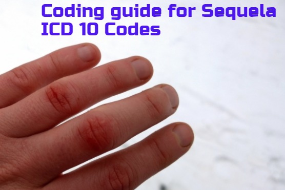Coding Guide for Sequela encounter ICD 10 Codes