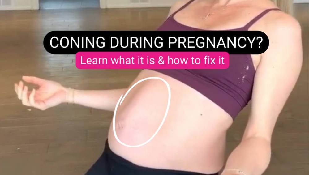 Coning-During-Pregnancy-Causes-Prevention-and-Recovery