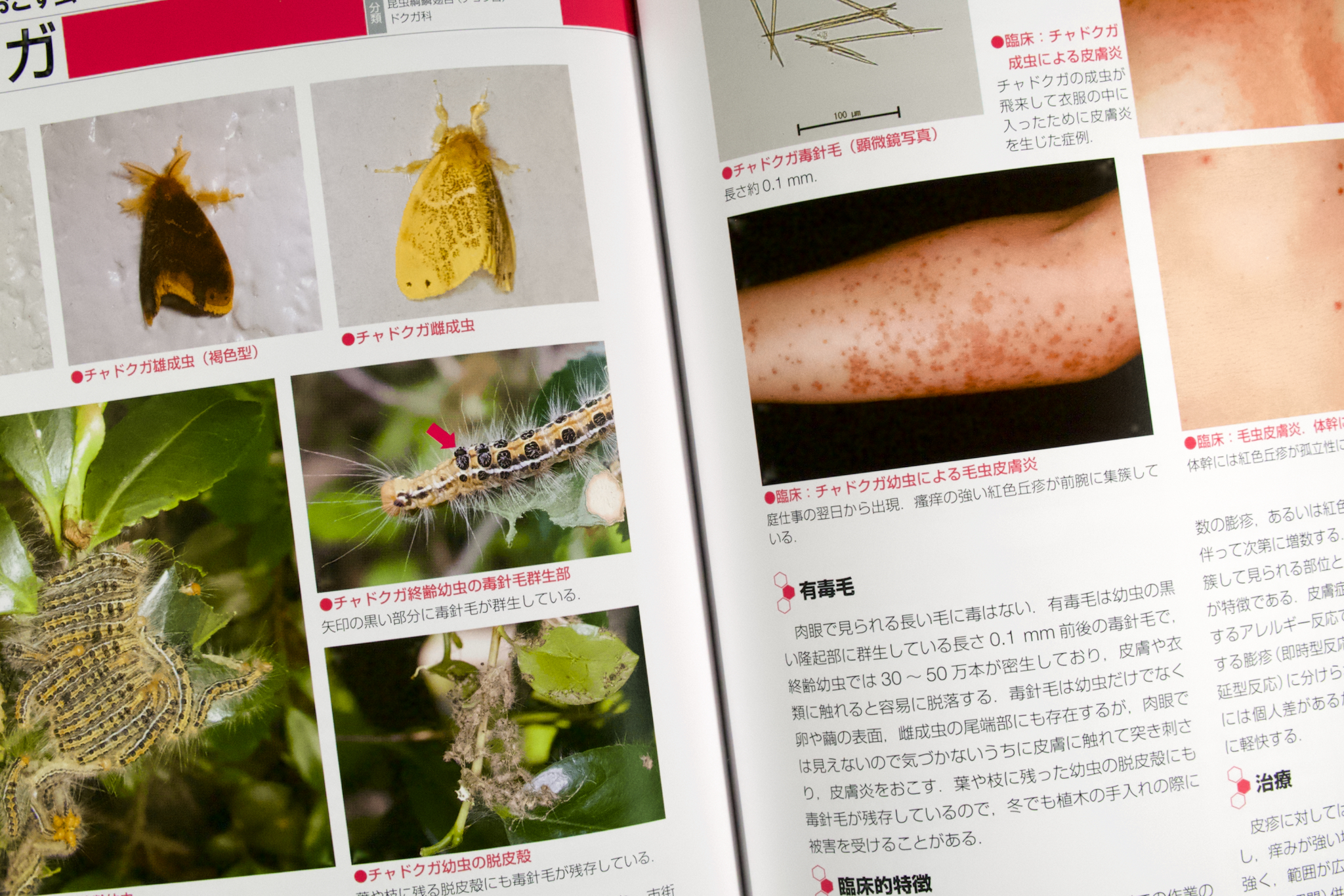 Dr.夏秋の臨床図鑑 虫と皮膚炎