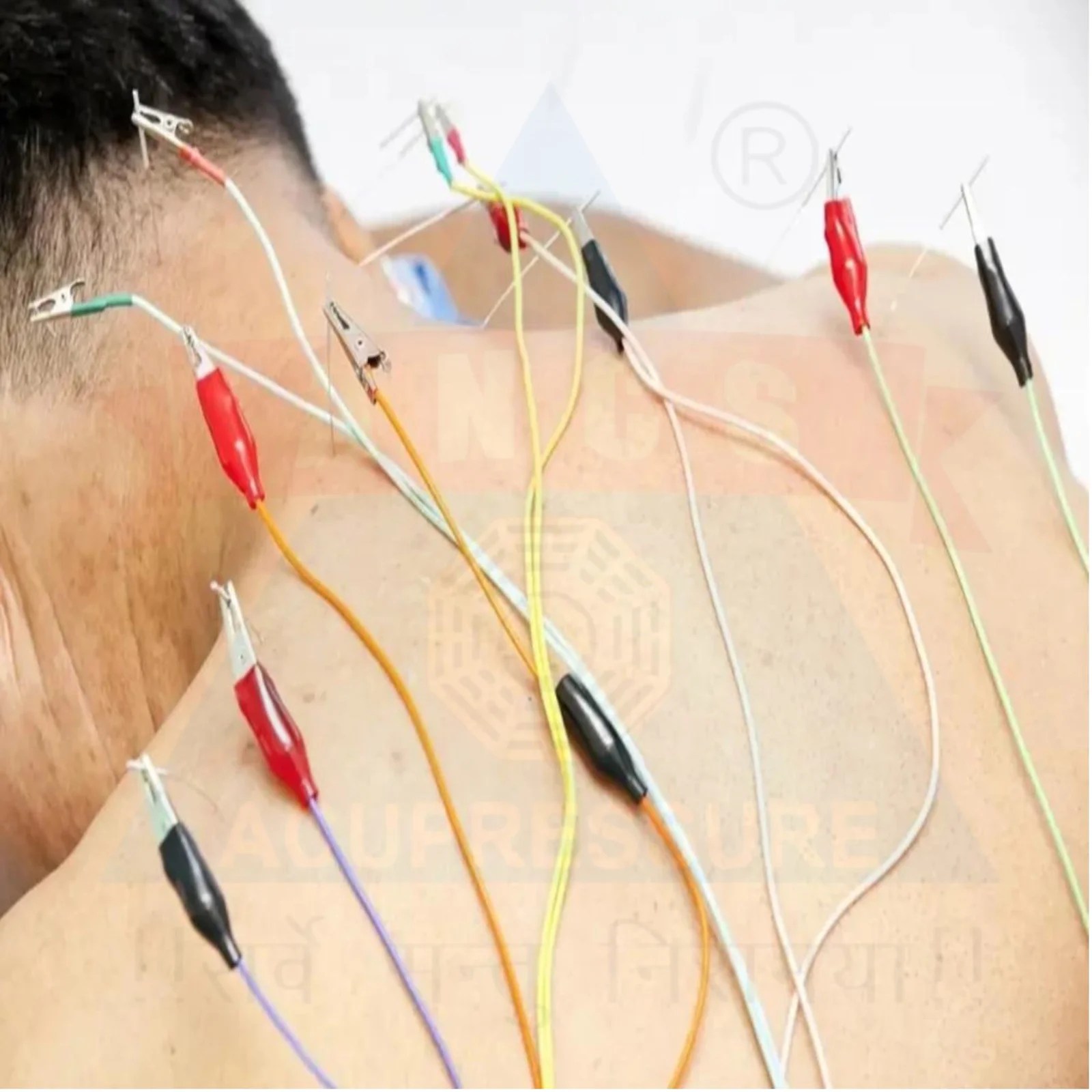 ancs-acupuncture-6-channels-stimulator-machine-how-can-use-needles