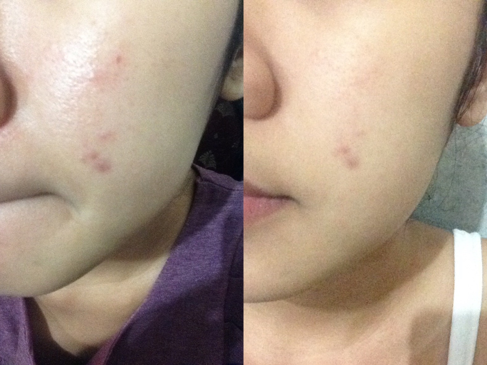 The body shop tea tree blemish gel · the body shop tea tree skin clearing foaming cleanser · the body shop tea tree skin clearing clay mask · the . Review My Holy Grail Tea Tree Oil From The Body Shop Andreayolanda