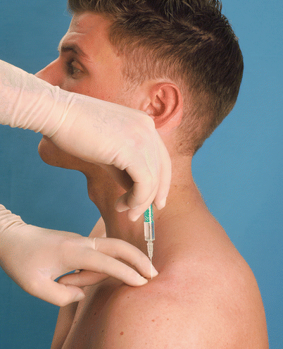 Glenohumeral and Acromioclavicular Joint Injection Traditional ...