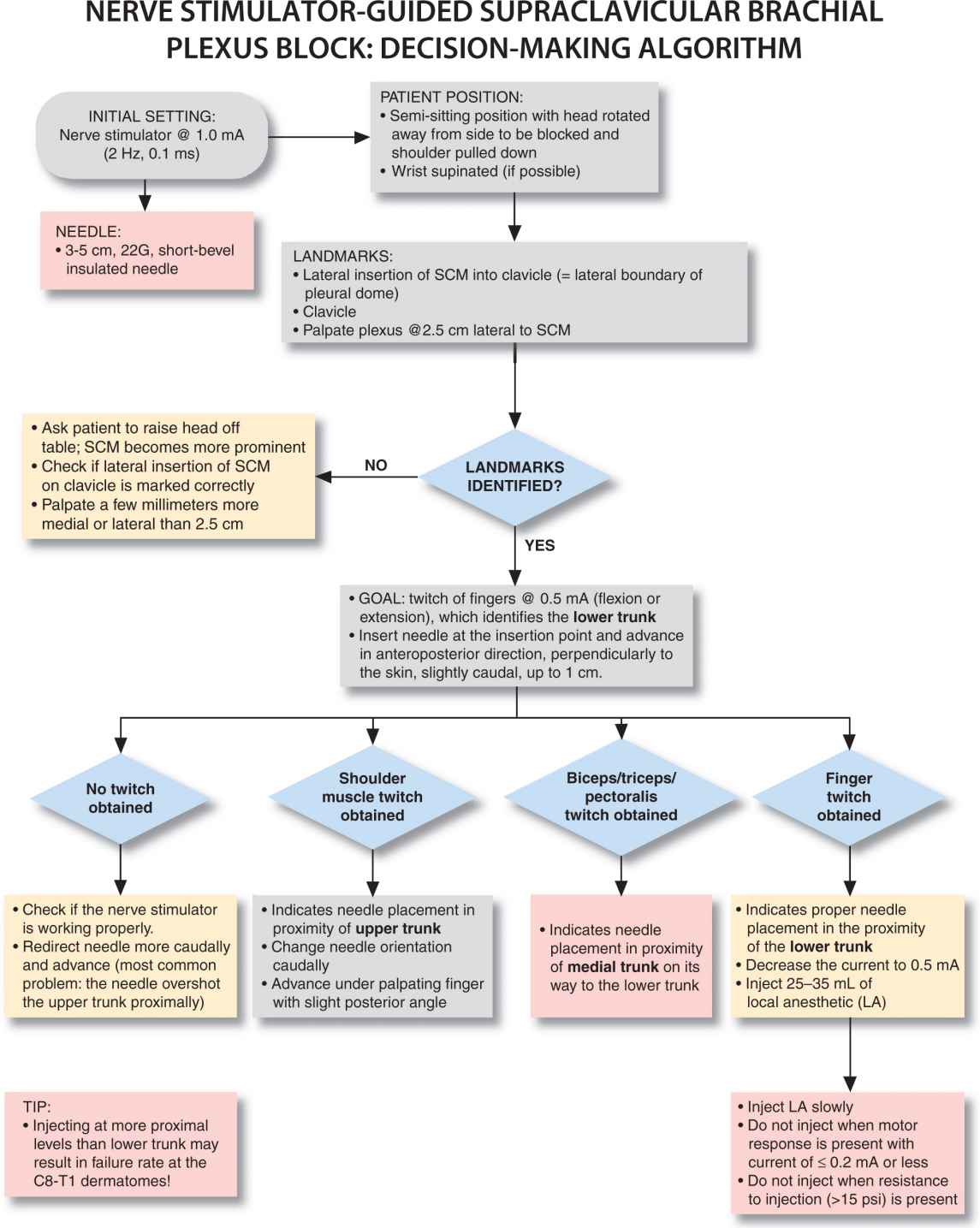 Supraclavicular Brachial Plexus Block Anesthesia Key