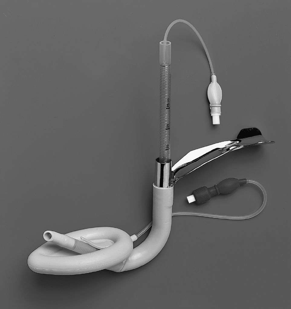 Assessment and Management of the Airway Anesthesia Key