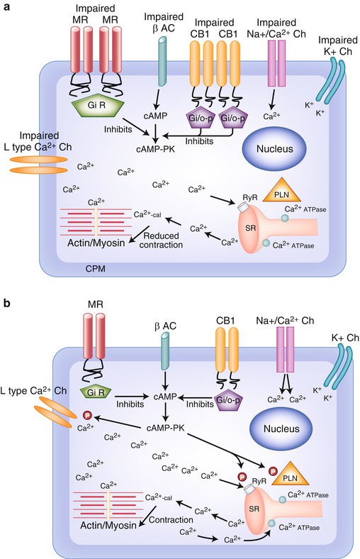 Cirrhotic Cardiomyopathy and Liver Transplantation | Anesthesia Key