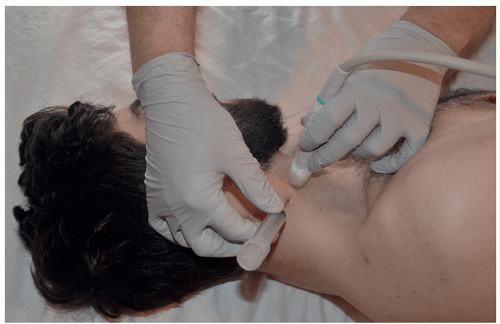Ultrasound-Guided Cervical Selective Nerve Root Block | Anesthesia Key