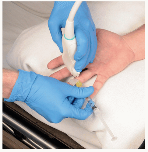 Ultrasound-Guided Metacarpal and Digital Nerve Block | Anesthesia Key