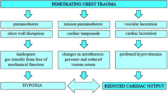 Thoracic Trauma | Anesthesia Key