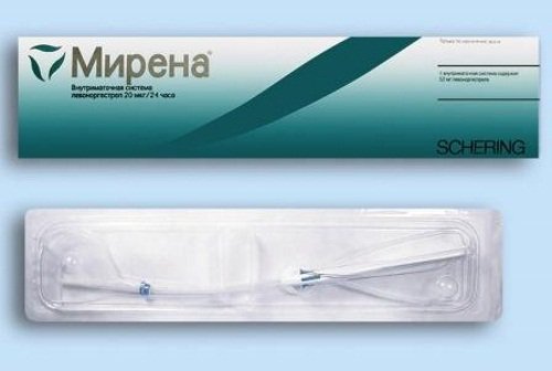 Снятие мирены. Плюсы и минусы гормональной спирали мирена. Что собой являет гормональная система Мирена