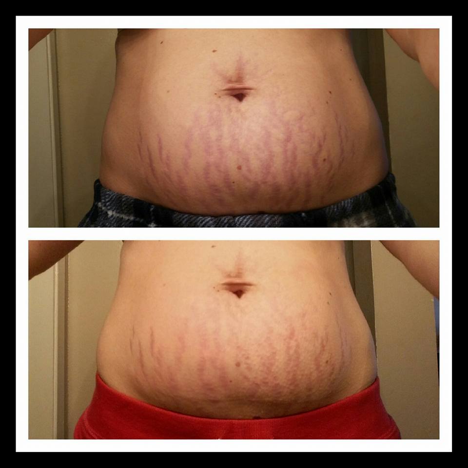 Healer stick before and after