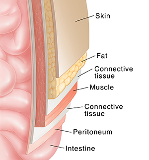 Here are some signs that your groin sweating may warrant further investigation: Anatomy Of The Abdomen And Groin Saint Luke S Health System