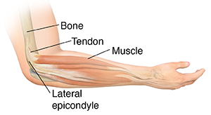 Pitcures Of The Tendons In Tbe Forearm : Understanding Lateral Epicondylitis Saint Luke S Health System