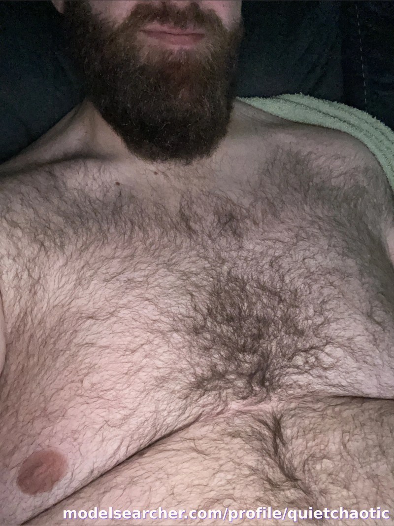 Micky Spotlight #fapsearcheri1