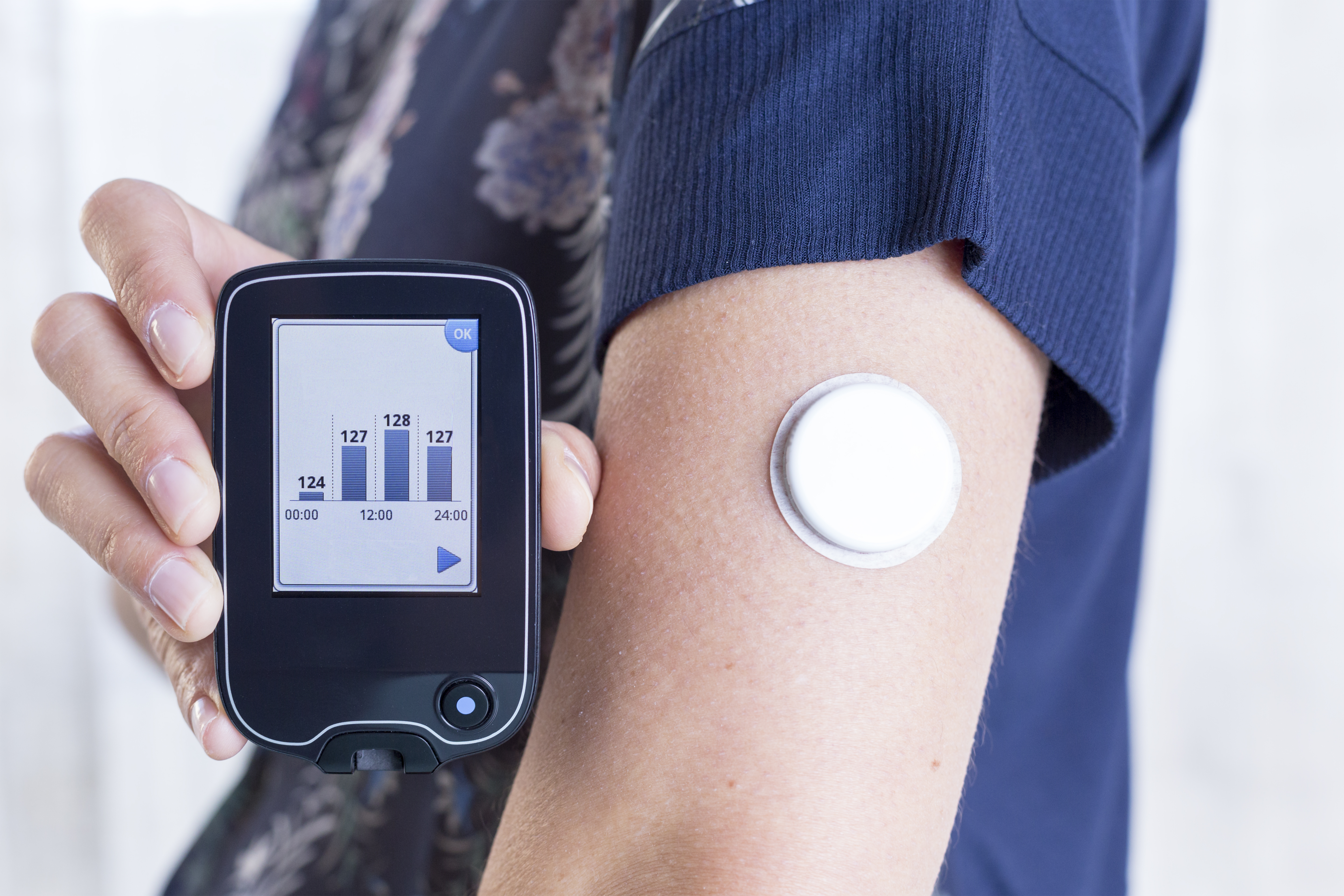 Healthy People Are Wearing Continuous Glucose Monitors | TIME