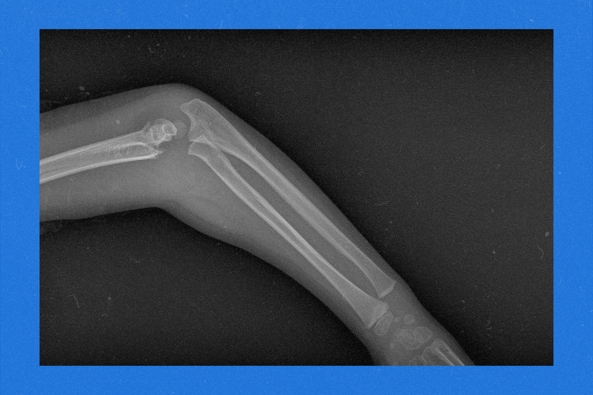 12 Symptoms That Endocrinologists Warn You Should Not Overlook