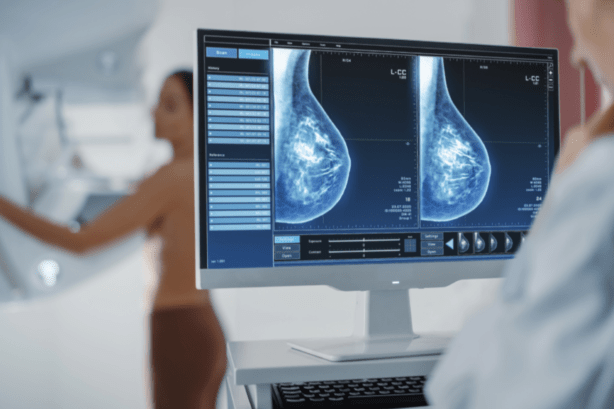 Mammogram