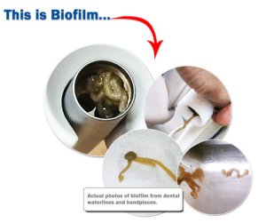 biofilm in dental waterlines