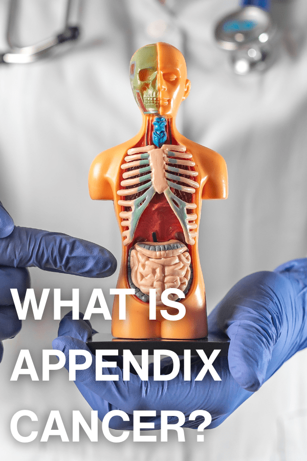 A colorful anatomical model  displaying internal organs with the text 'WHAT IS APPENDIX CANCER?'