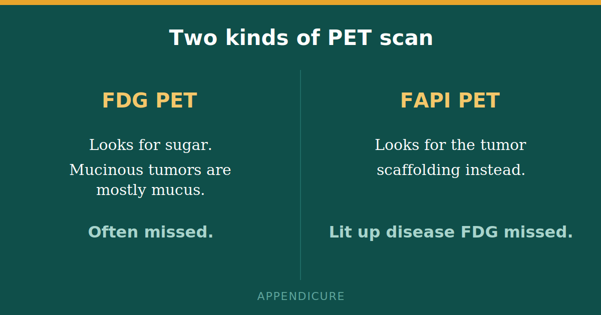 Appendix cancer imaging comparison of FDG PET and FAPI PET