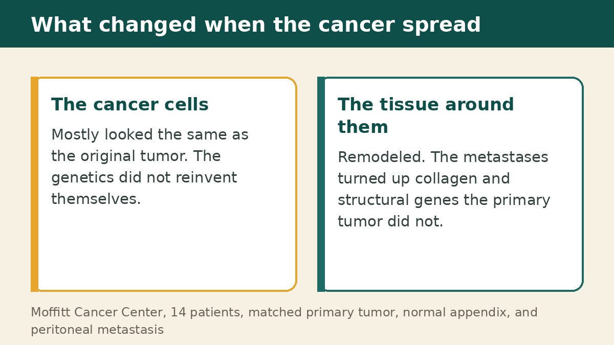 What changed in the appendix cancer tumor microenvironment when the cancer spread, cancer cells stayed similar while the surrounding tissue remodeled collagen