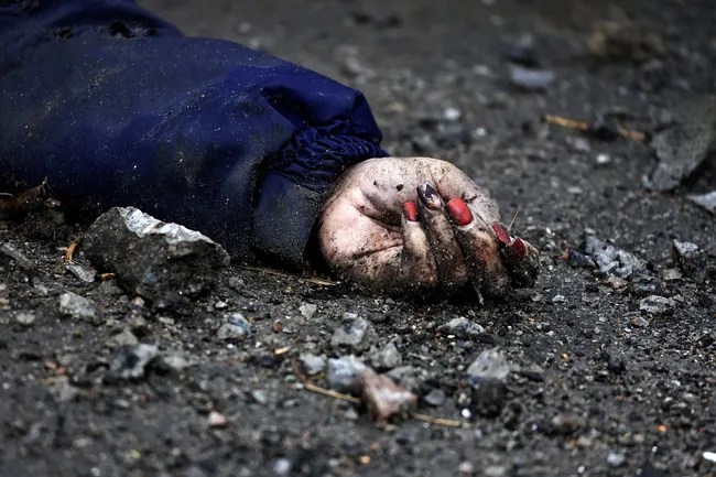 La mano de una mujer asesinada por el ejército ruso en Bucha