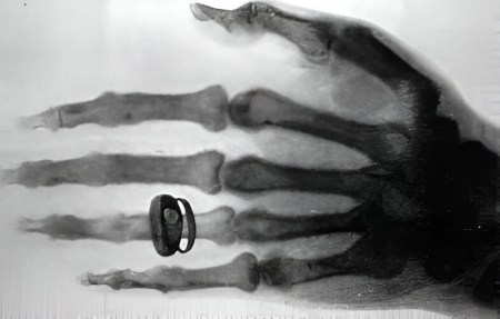The First X-Ray
