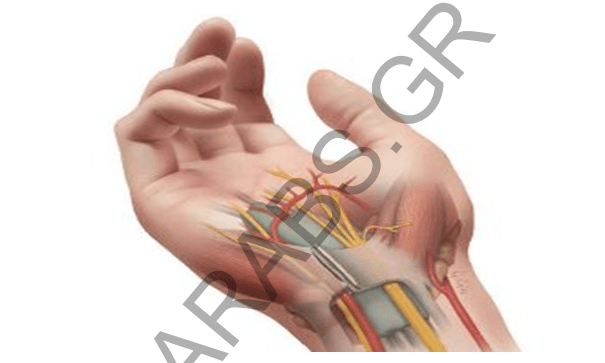 كيفية علاج متلازمة النفق الرسغي متلازمة النفق التعليم والنشاط المهني في عام 2009 ، تخرج من أكاديمية ياروسلافل الطبية الحكومية ØªØ§Ø¬ Ø§ÙØµØ­Ø© ÙØ¹ Ø§ÙØ¯ÙØªÙØ± ÙØ£ÙÙÙ ÙØ³Ø¹ÙØ¯ ÙÙØ§Ù Ø§ÙÙÙÙ Ø¨Ø¹ÙÙØ§Ù ÙØªÙØ§Ø²ÙØ© ÙÙÙ Ø§ÙØ±Ø³Øº Ø¥Ø­Ø¯Ù Ø£ÙÙ Ø£Ø³Ø¨Ø§Ø¨ Ø¢ÙØ§Ù Ø§ÙØ±Ø³Øº
