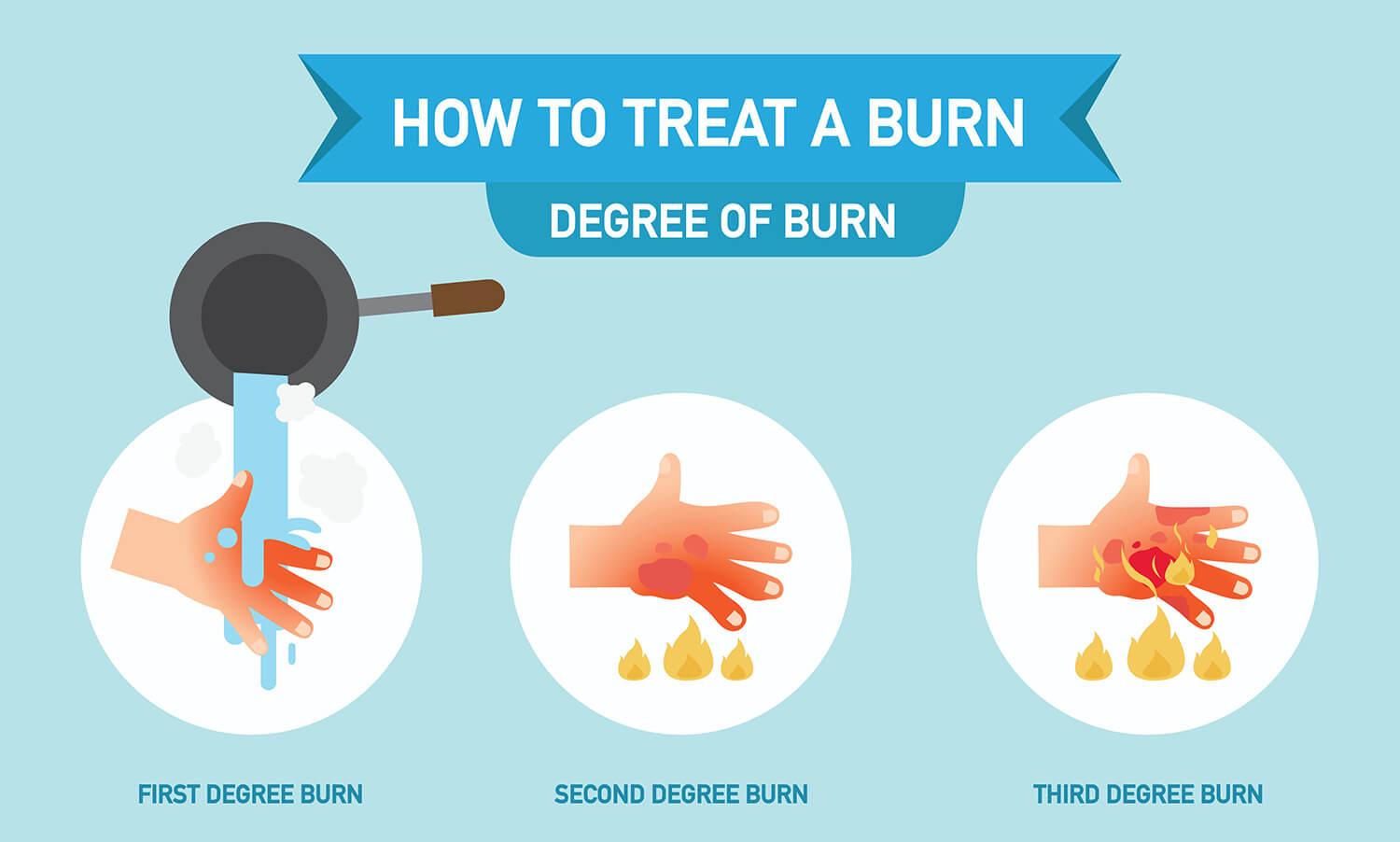 Ointments you can put on a burn (plus aftercare) goodrx, 48% off