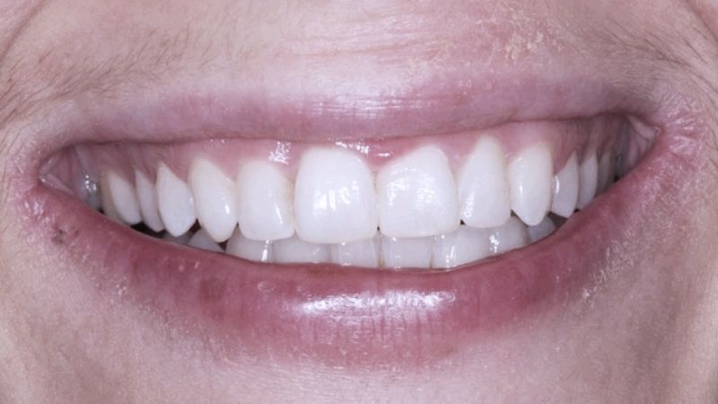 After Face Archformbyte Ltd - Download Incredible Gradient Pattern | 8K