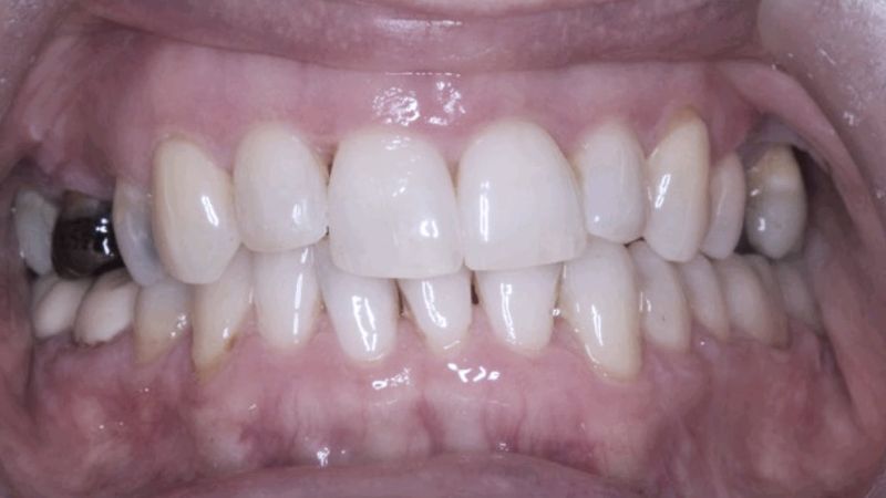 After Face Archformbyte Ltd - Best Sunset Patterns in Ultra HD