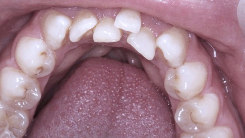 Before Face Archformbyte Ltd - Beautiful Dark Design - 4K